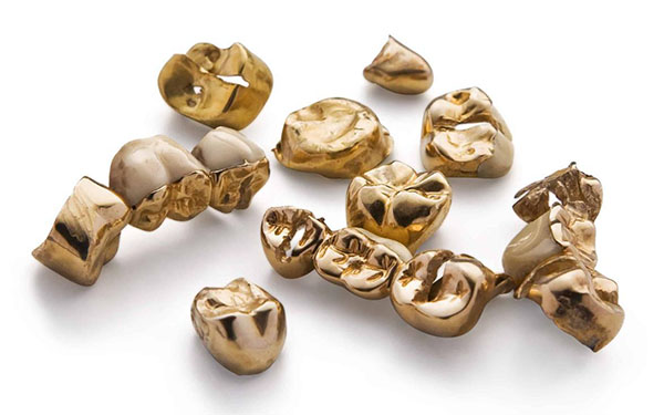 Zahngold ankaufen Wismar